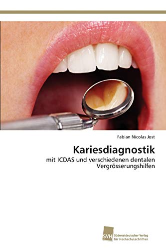 9783838150338: Kariesdiagnostik: mit ICDAS und verschiedenen dentalen Vergrsserungshilfen