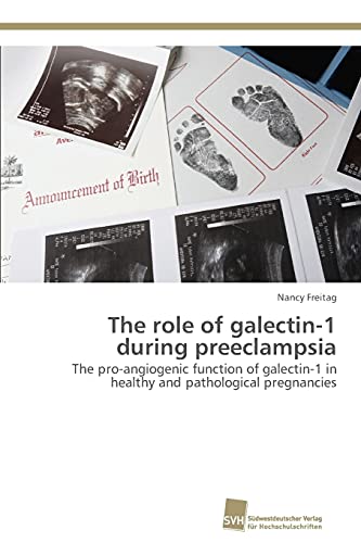Stock image for The role of galectin-1 during preeclampsia for sale by Lucky's Textbooks