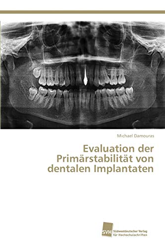 9783838150727: Evaluation der Primrstabilitt von dentalen Implantaten
