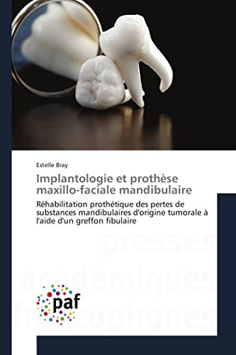 9783841631091: Implantologie et prothse maxillo-faciale mandibulaire: Rhabilitation prothtique des pertes de substances mandibulaires d'origine tumorale  l'aide d'un greffon fibulaire (French Edition)