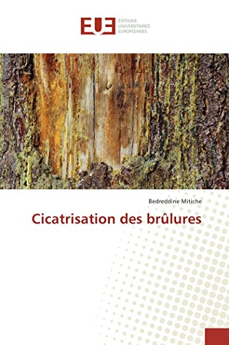 9783841729743: Cicatrisation des brlures (French Edition)