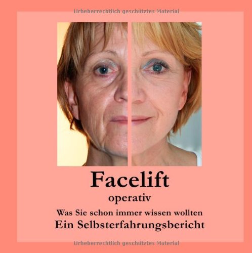 Beispielbild fr Facelift operativ: Was Sie schon immer wissen wollten Ein Selbsterfahrungsbericht zum Verkauf von Antiquariat Armebooks