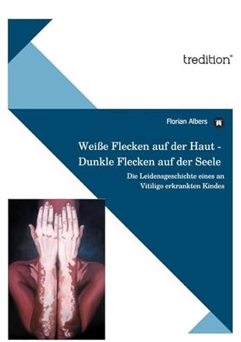 Weiße Flecken auf der Haut - Dunkle Flecken auf der Seele: Die Leidensgeschichte eines an Vitiligo erkrankten Kindes - Albers Florian