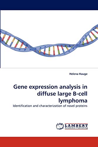 Stock image for Gene expression analysis in diffuse large B-cell lymphoma: Identification and characterization of novel proteins for sale by Lucky's Textbooks