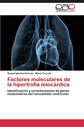 9783844347197: Factores moleculares de la hipertrofia miocrdica: Identificacin y caracterizacin de genes moduladores del remodelado ventricular