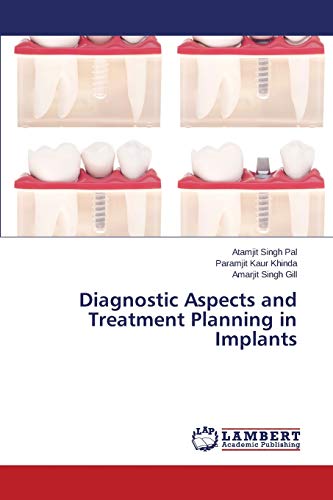 Stock image for Diagnostic Aspects and Treatment Planning in Implants for sale by Lucky's Textbooks