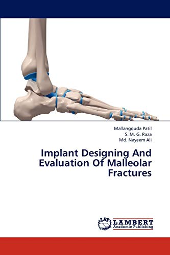 9783847321156: Implant Designing and Evaluation of Malleolar Fractures