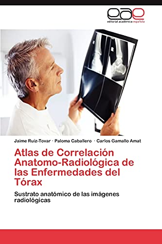 Beispielbild fr Atlas de Correlacin Anatomo-Radiolgica de las Enfermedades del Trax : Sustrato anatmico de las imgenes radiolgicas zum Verkauf von Buchpark