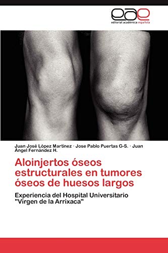 Stock image for Aloinjertos seos estructurales en tumores seos de huesos largos: Experiencia del Hospital Universitario "Virgen de la Arrixaca" (Spanish Edition) for sale by Lucky's Textbooks