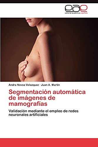 Beispielbild fr Segmentacin automtica de imgenes de mamografas: Validacin mediante el empleo de redes neuronales artificiales (Spanish Edition) zum Verkauf von Lucky's Textbooks