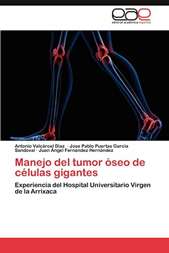 Stock image for Manejo del tumor seo de clulas gigantes: Experiencia del Hospital Universitario Virgen de la Arrixaca (Spanish Edition) for sale by Lucky's Textbooks