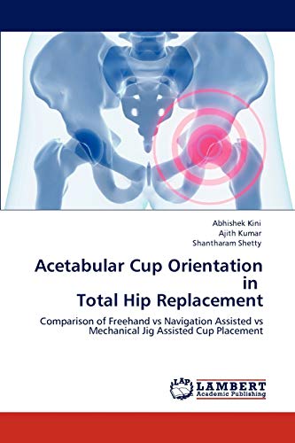Beispielbild fr Acetabular Cup Orientation in Total Hip Replacement: Comparison of Freehand vs Navigation Assisted vs Mechanical Jig Assisted Cup Placement zum Verkauf von Lucky's Textbooks