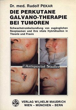 Rudolf Pekar (Autor) - Die Perkutane Galvano-Therapie bei Tumoren: Schwachstrombehandlung