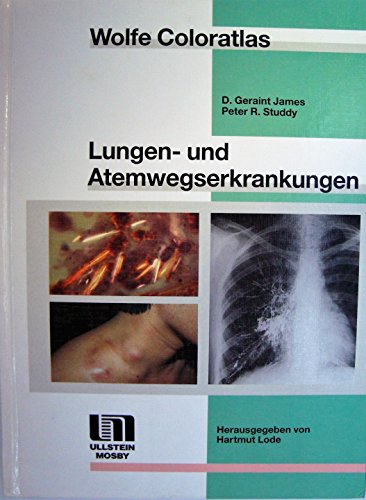 Stock image for Wolfe Coloratlas: Lungen- und Atemwegserkrankungen for sale by Kultgut
