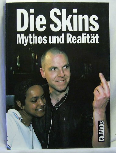 Die Skins Mythos und Realität.