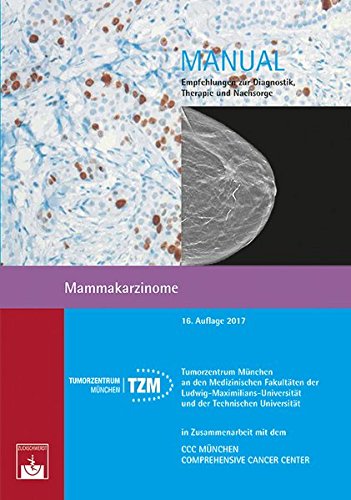 Imagen de archivo de Mammakarzinome: Empfehlungen zur Diagnostik, Therapie und Nachsorge (Manuale Tumorzentrum Mnchen) a la venta por medimops