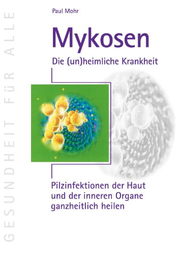 Beispielbild fr Mykosen - Die (un)heimliche Krankheit: Pilzinfektionen der Haut und der inneren Organe ganzheitlich heilen zum Verkauf von medimops