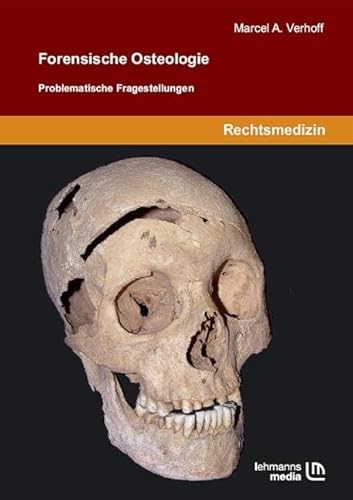 Imagen de archivo de Forensische Osteologie: Problematische Fragestellungen a la venta por Revaluation Books