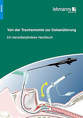 Von der Tracheotomie zur Dekanülierung : Ein transdisziplinäres Handbuch - Unknown Author