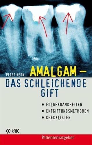 Beispielbild fr Amalgam - das schleichende Gift. Folgekrankheiten, Entgiftungsmethoden, Checklisten zum Verkauf von medimops