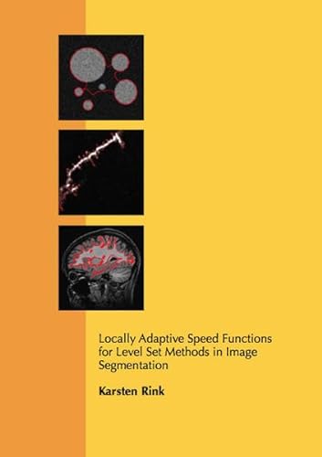 Beispielbild fr Locally Adaptive Speed Functions for Level Set Methods in Image Segmentation (Informatik) zum Verkauf von Buchpark