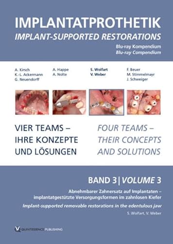 Implantatprothetik. Blu-Ray, Band 3 : Vier Team - Ihre Konzepte und Lösungen, Implantatprothetik. Blu-ray-Kompendium 3, Vier Teams - Ihre Konzepte und Lösungen / Four teams - their concepts and solutions - Prof Dr Stefan Wolfart