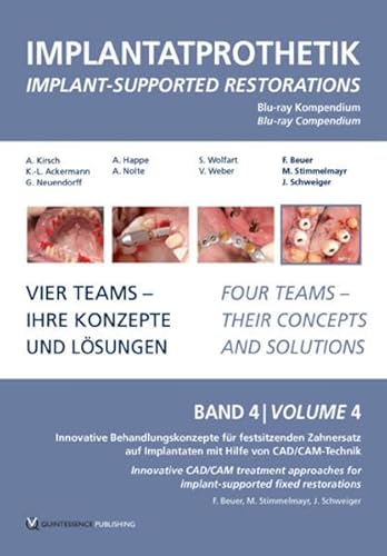 DVD-Kompendium Implantatprothetik 4 : Blu-Ray Edition - Florian Beuer