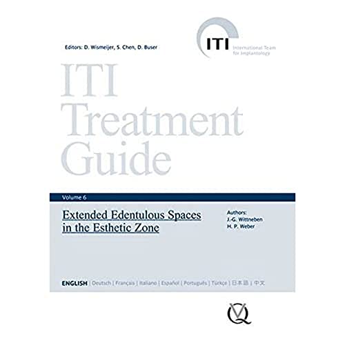 Stock image for Extended Edentulous Spaces in the Esthetic Zone (6) (ITI Treatment Guide) for sale by WorldofBooks