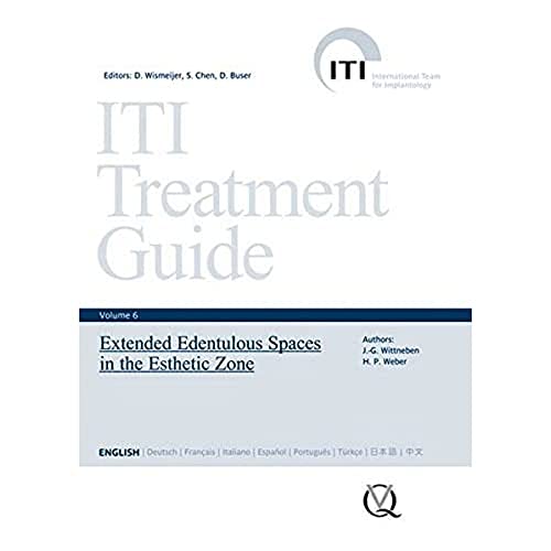 9783868671414: Extended Edentulous Spaces in the Esthetic Zone (6) (ITI Treatment Guide)