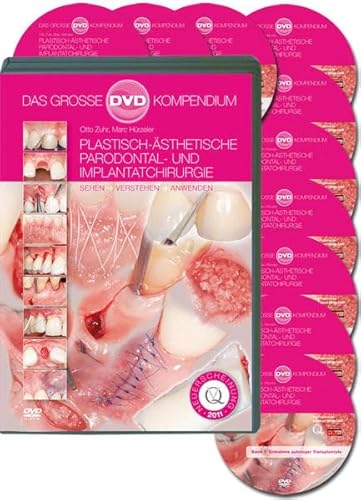 Plastisch-Ästhetische Parodontal- und Implantatchirurgie, 10 DVDs - Otto Zuhr