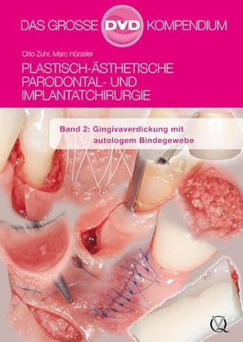 Plastisch-Ästhetische Parodontal- und Implantatchirurgie