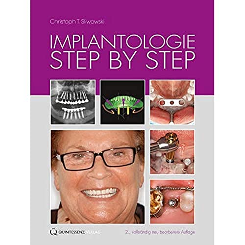 9783868671841: Implantologie Step by Step