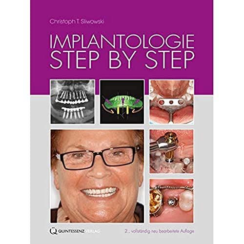 Stock image for Implantologie Step by Step for sale by Versandantiquariat Ursula Ingenhoff