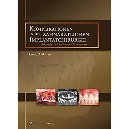 9783868671872: Komplikationen in der zahnrztlichen Implantatchirurgie: tiologie, Prvention und Management