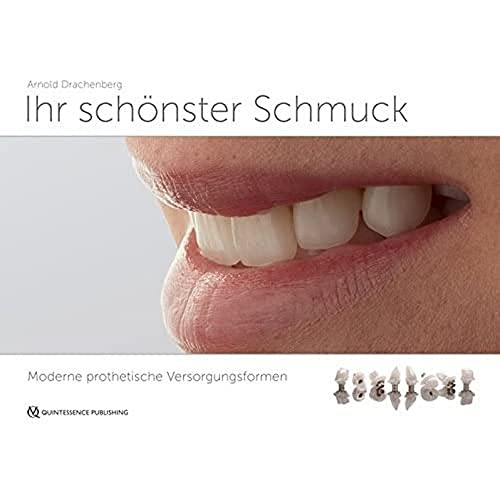 Stock image for Ihr schnster Schmuck: Moderne prothetische Versorgungsformen for sale by medimops