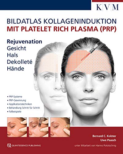 Stock image for Bildatlas Platelet Rich Plasma (PRP) -Language: german for sale by GreatBookPrices