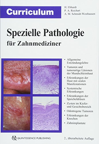 Stock image for Curriculum Spezielle Pathologie fr Zahnmediziner for sale by Revaluation Books