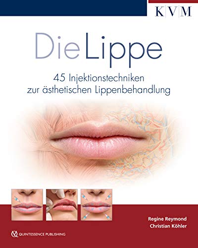 Stock image for Die Lippe: 45 Injektionstechniken zur sthetischen Lippenbehandlung for sale by Revaluation Books