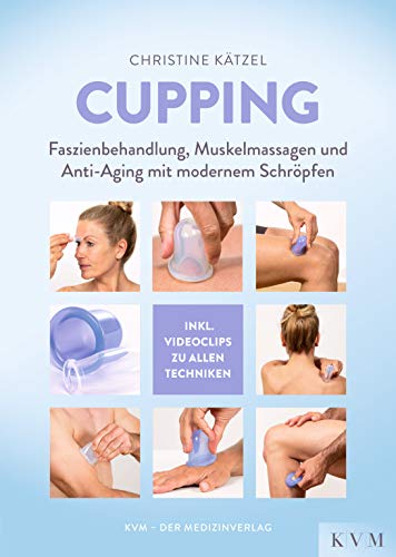 Stock image for Cupping for sale by Blackwell's