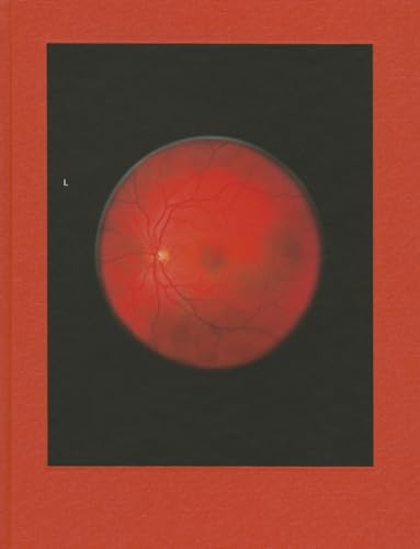 Stock image for RETINAL SHIFT for sale by Librairie Couleur du Temps