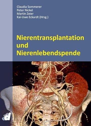 Stock image for Nierentransplantation und Nierenlebendspende for sale by Revaluation Books