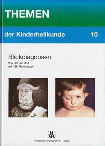 Imagen de archivo de Blickdiagnosen (Themen der Kinderheilkunde) a la venta por medimops