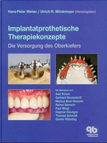 Beispielbild fr Implantatprothetische Therapiekonzepte zum Verkauf von medimops