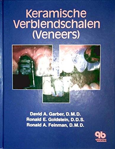 9783876523019: Keramische Verblendschalen (Veneers) - Garber, David A