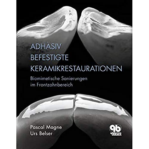 9783876523682: Adhsiv befestigte Keramikrestaurationen.