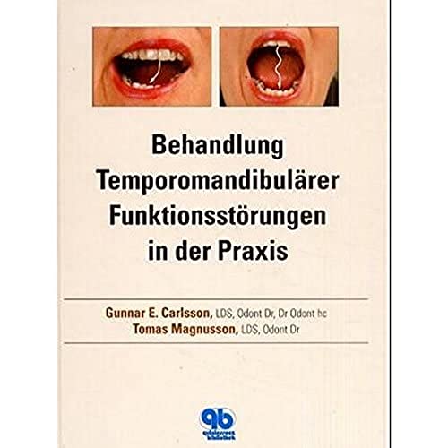 Beispielbild fr Behandlung Temporomandibulrer Funktionsstrungen in der Praxis zum Verkauf von medimops