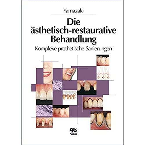 Imagen de archivo de Die sthetisch-restaurative Behandlung a la venta por medimops