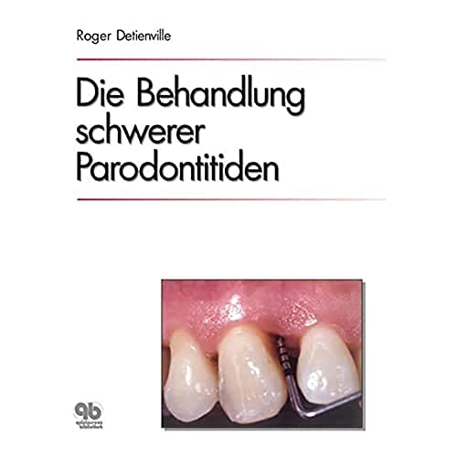 9783876526386: Die Behandlung schwerer Parodontitiden