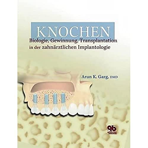 9783876526720: Knochen: Biologie, Gewinnung, Transplantation in der zahnrztlichen Implantologie