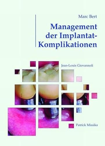 9783876527024: Management der Implantat- Komplikationen